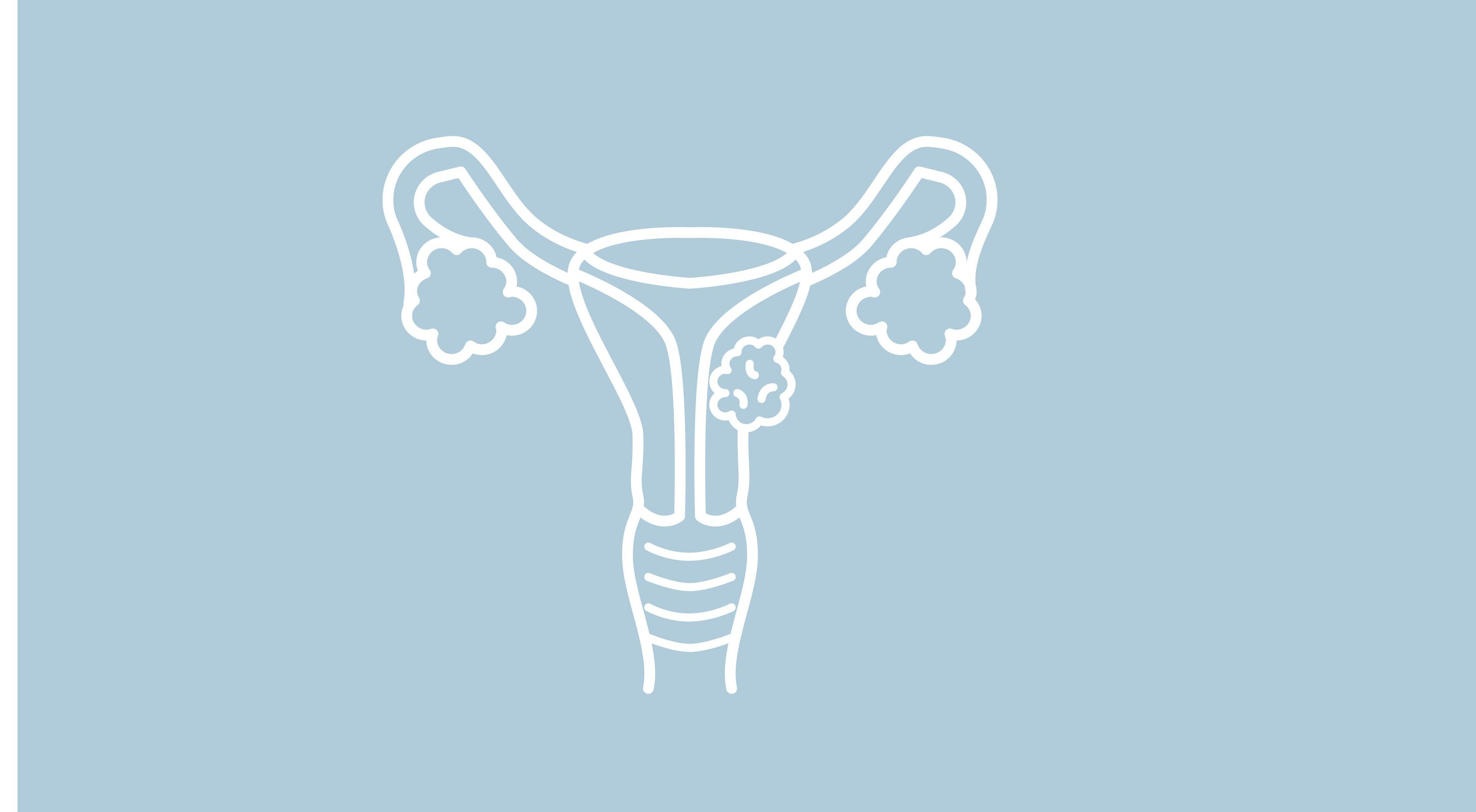 ovary, uterus, fallopian tube