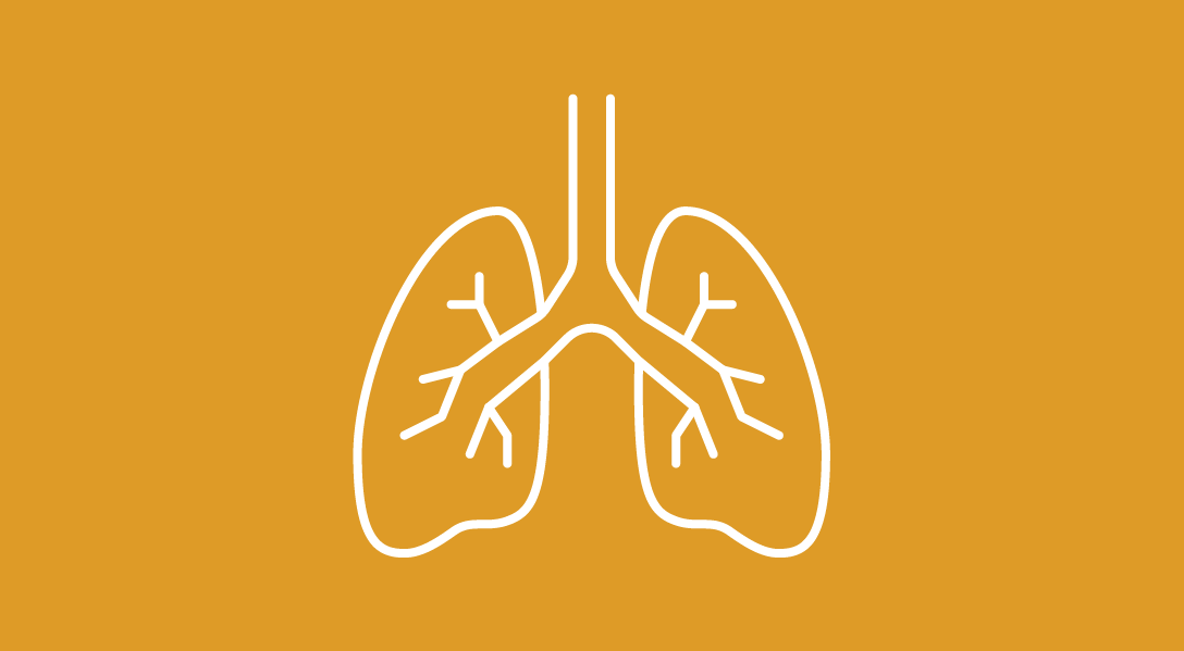 Patients With NSCLC May Prefer Subcutaneous vs IV Atezolizumab