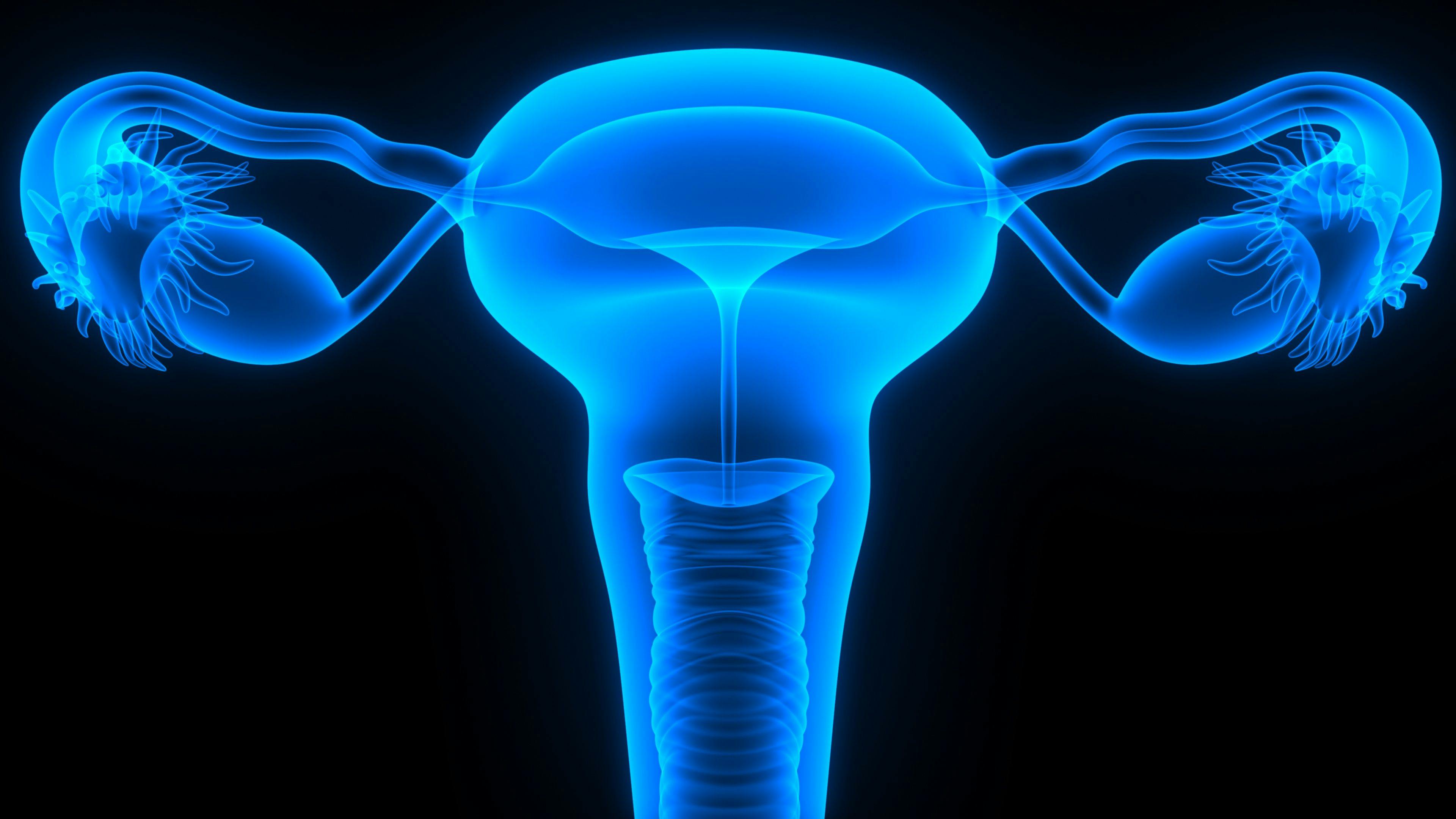 Frontline Maintenance Niraparib May Not Worsen HRQOL in Advanced Ovarian Cancer