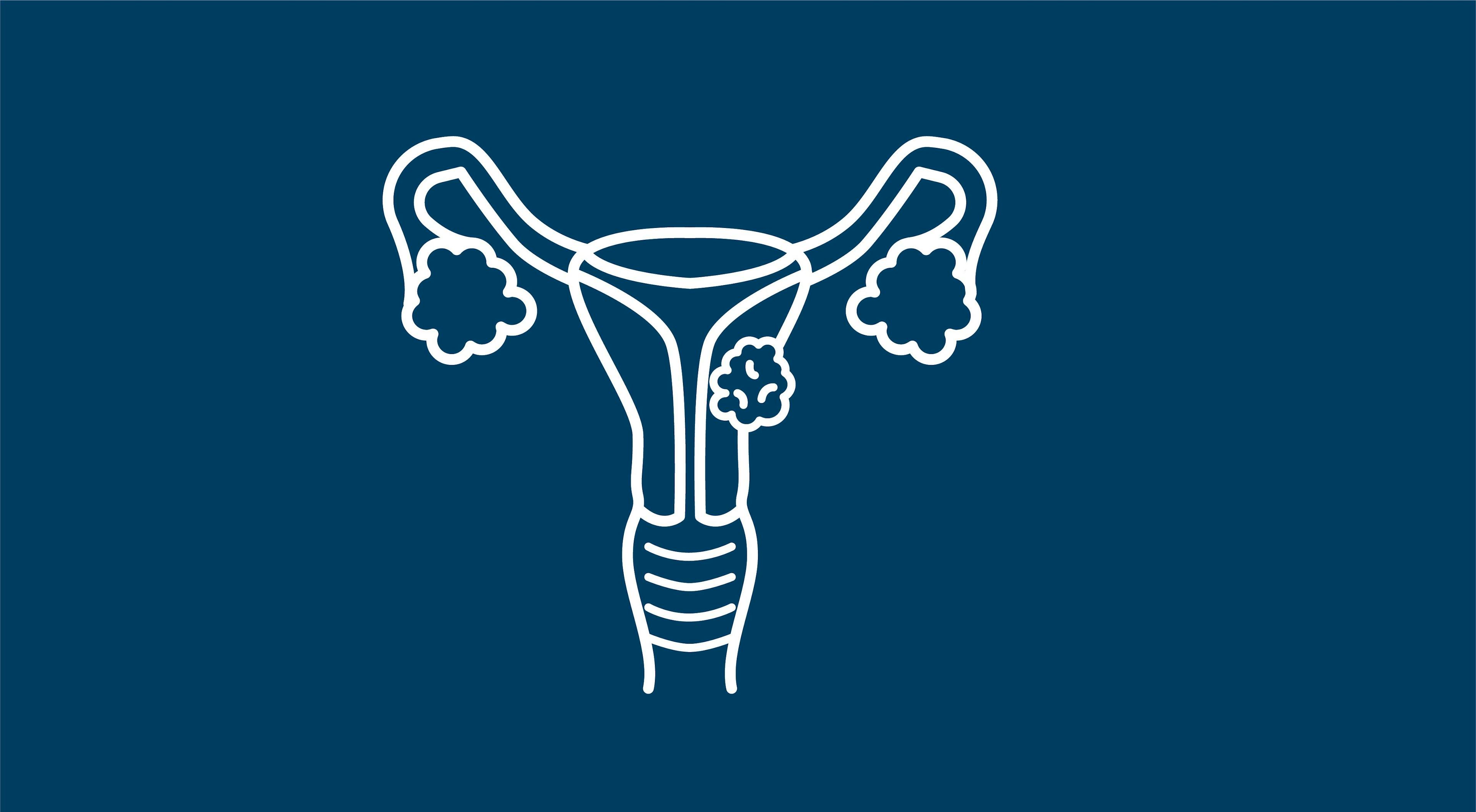 USPSTF Offers Choice in Testing for Women at Average Risk for Cervical Cancer