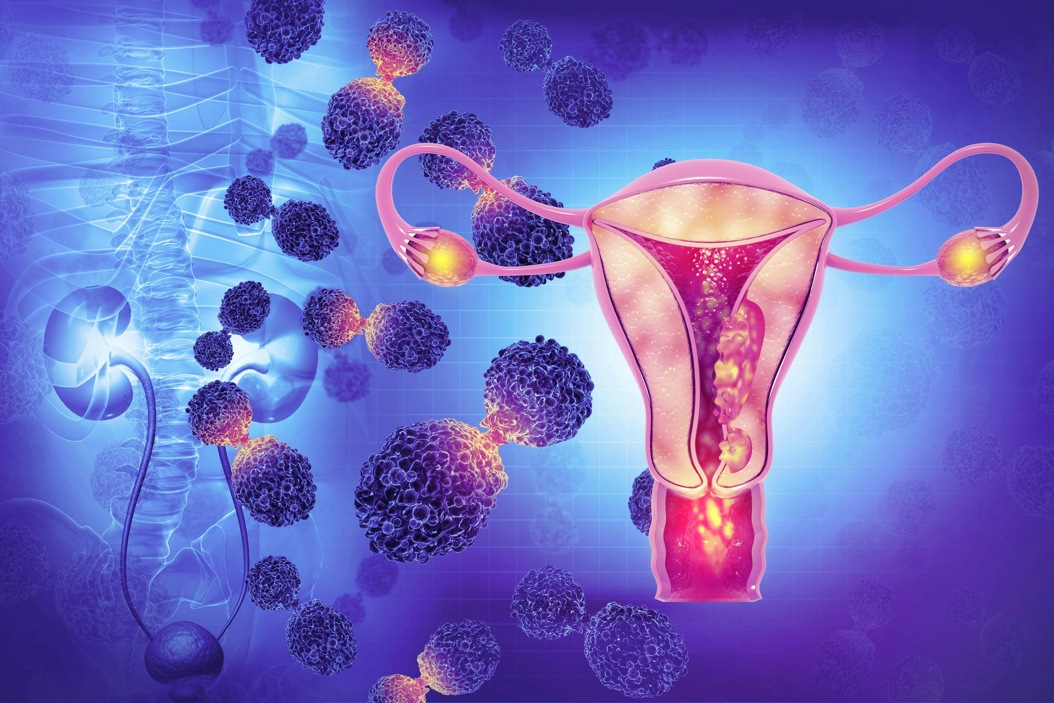 Adverse Effect Management for Immunotherapies in Advanced Endometrial Cancer