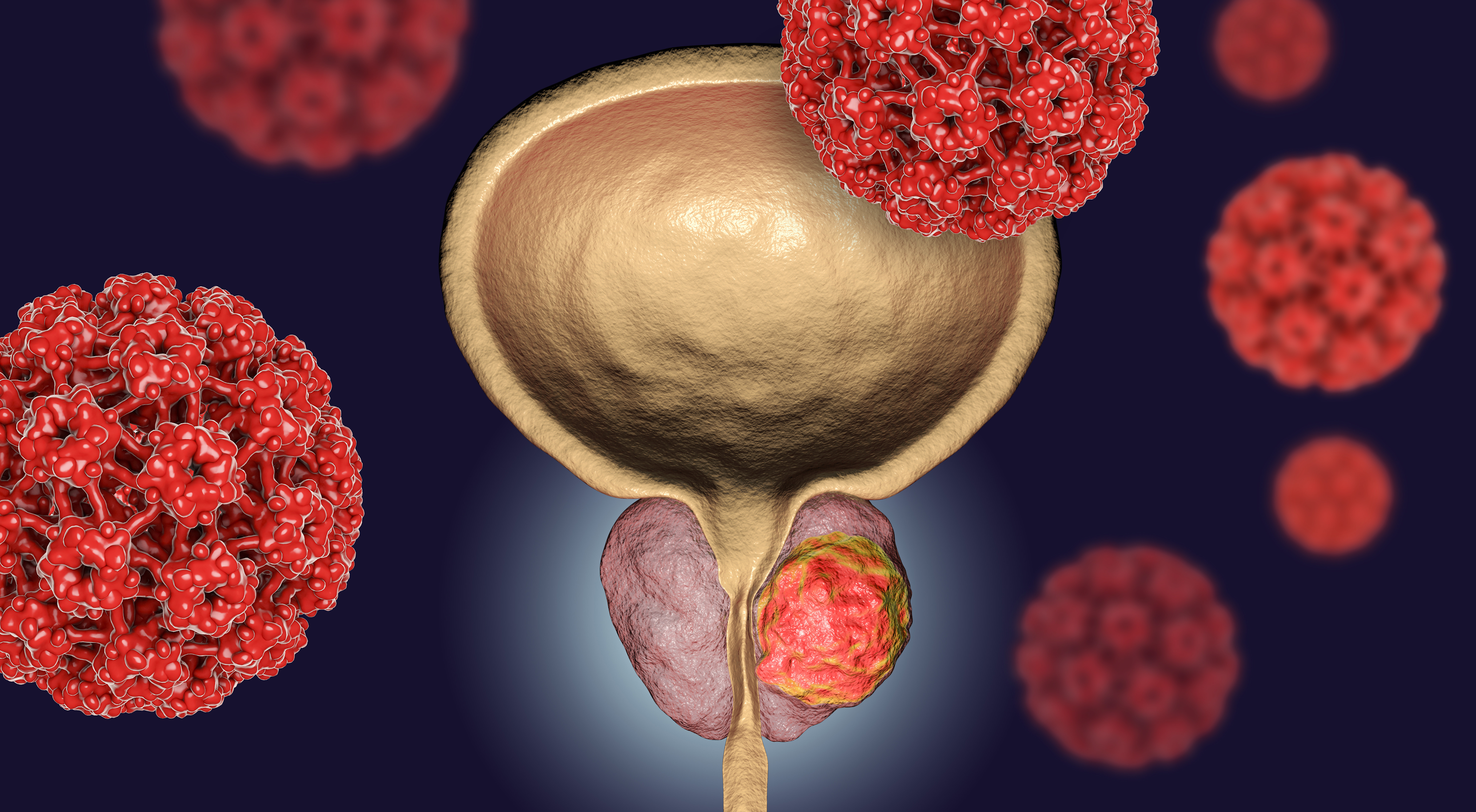 Enfortumab Vedotin Plus Pembrolizumab Improves Outcomes vs Chemo in Urothelial Cancer