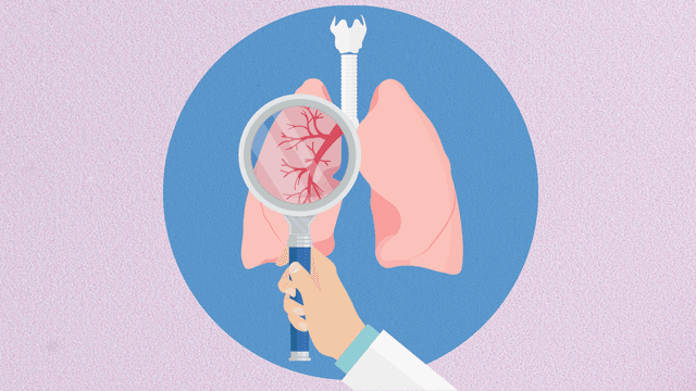 doctor holding magnifying class near lung