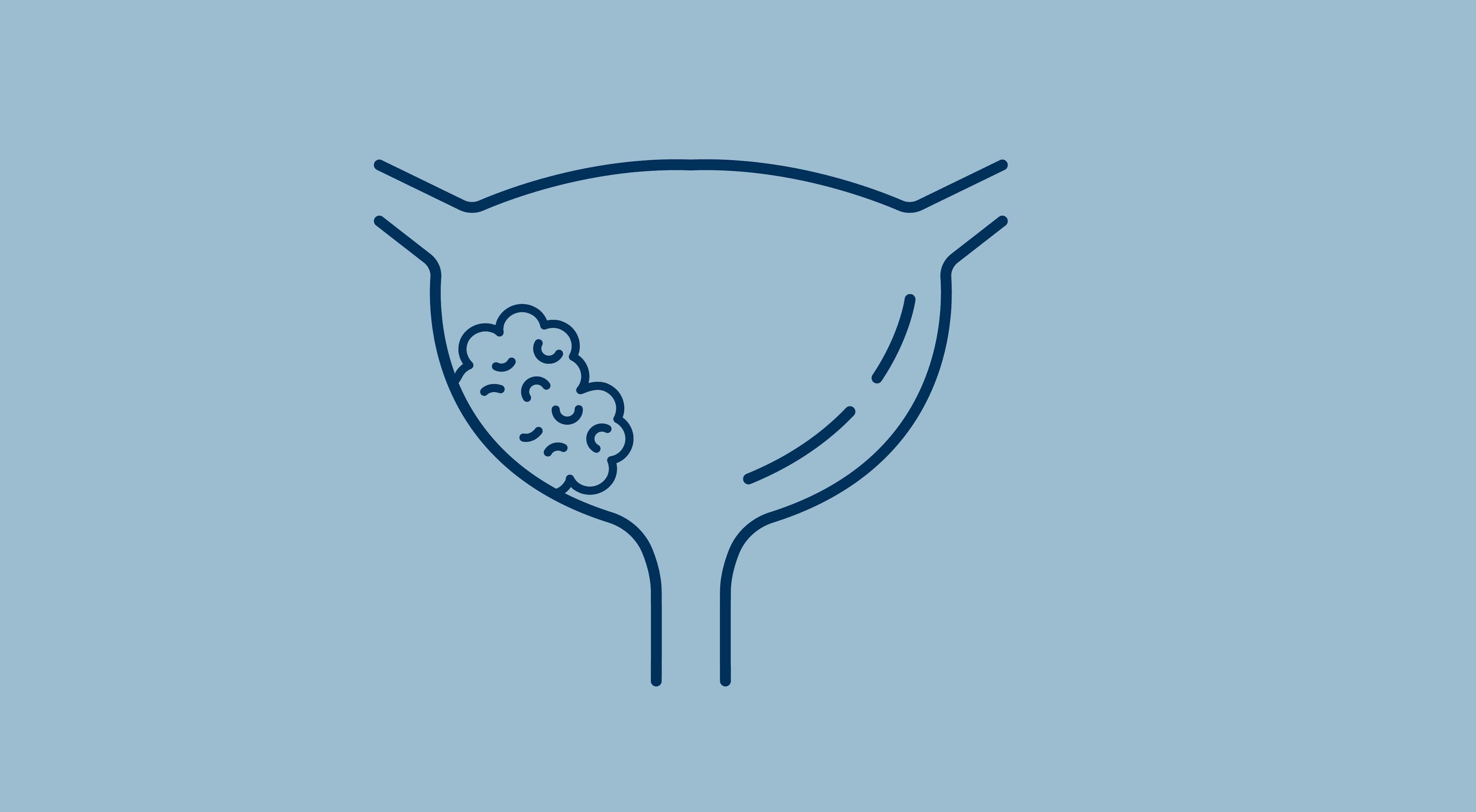 Enfortumab Vedotin Plus Pembrolizumab May Not Negatively Affect Quality of Life in Metastatic Urothelial Cancer