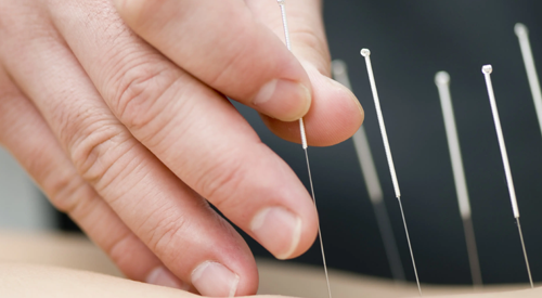 Acupuncture May Reduce Hot Flashes in Patients With Breast Cancer Undergoing Endocrine Therapy