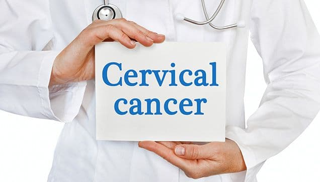 clinician in white coat holding a board that says "cervical cancer"